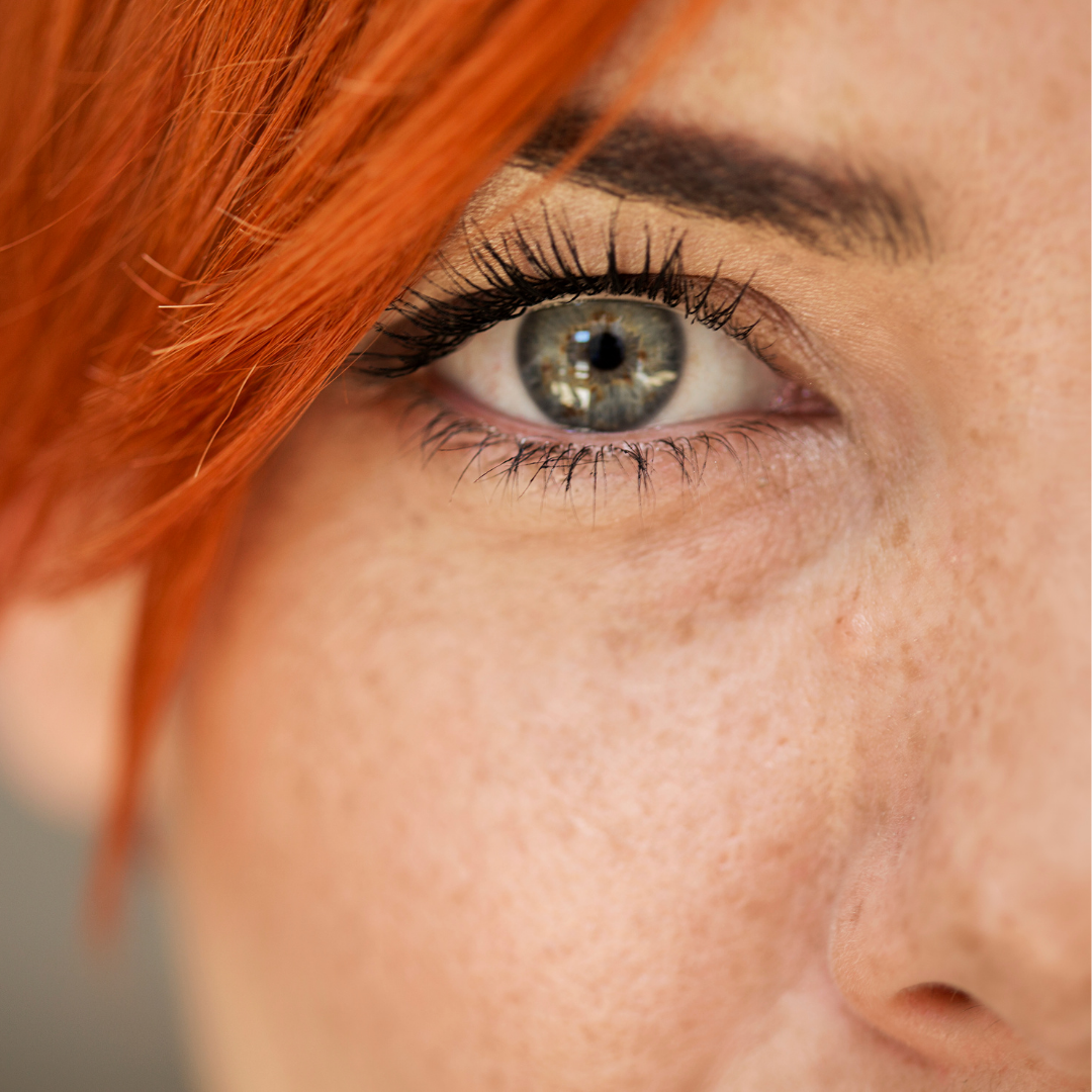 The delicate eye area